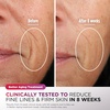 image:imageShark CryoGlow LED Face Mask in Rose Glow FW312PK  1 Skincare Facial Device in the US Combining HighEnergy LEDs Deep Infrared amp UnderEye CoolingLilac Chill