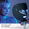 image:imageShark CryoGlow LED Face Mask in Rose Glow FW312PK  1 Skincare Facial Device in the US Combining HighEnergy LEDs Deep Infrared amp UnderEye CoolingLilac Chill