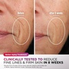 image:imageShark CryoGlow LED Face Mask in Rose Glow FW312PK  1 Skincare Facial Device in the US Combining HighEnergy LEDs Deep Infrared amp UnderEye CoolingRose Glow