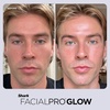 image:imageShark FacialPro Glow Replenishment Kit XSKFH3  AHA  BHA Exfoliation Gel amp BHA HydratorLilac